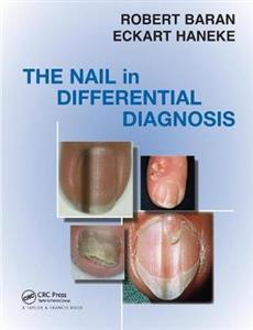 Nail in Differential Diagnosis - Click Image to Close