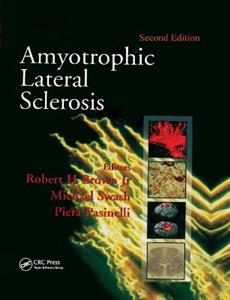 Amyotrophic Lateral Sclerosis, Second Edition