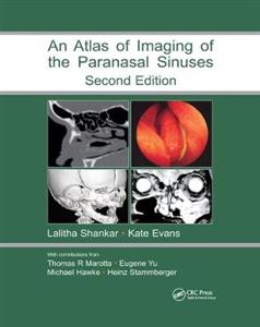Atlas of Imaging of the Paranasal Sinuses, Second Edition - Click Image to Close