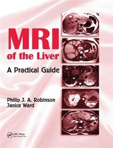 MRI of the Liver - Click Image to Close