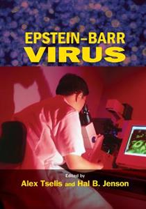 Epstein-Barr Virus - Click Image to Close