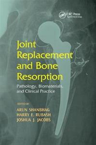 Joint Replacement and Bone Resorption - Click Image to Close