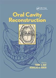 Oral Cavity Reconstruction - Click Image to Close