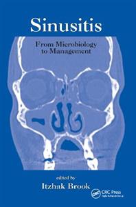 Sinusitis - Click Image to Close