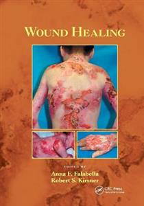 Wound Healing - Click Image to Close