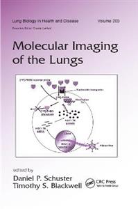 Molecular Imaging of the Lungs - Click Image to Close