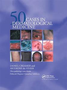 Fifty Dermatological Cases - Click Image to Close