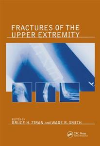 Fractures of the Upper Extremity - Click Image to Close