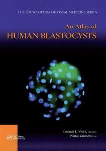 An Atlas of Human Blastocysts - Click Image to Close