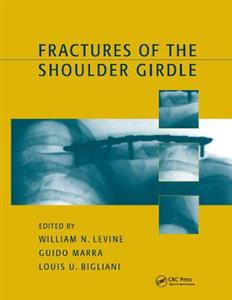 Fractures of the Shoulder Girdle - Click Image to Close