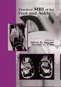 Practical MRI of the Foot and Ankle - Click Image to Close