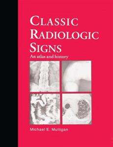 Classic Radiologic Signs - Click Image to Close