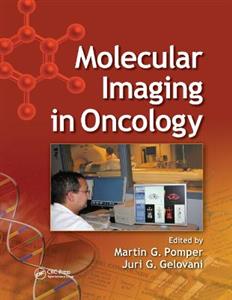 Molecular Imaging in Oncology - Click Image to Close