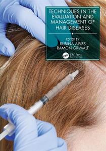 Techniques in the Evaluation and Management of Hair Diseases - Click Image to Close