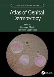 Atlas of Genital Dermoscopy - Click Image to Close