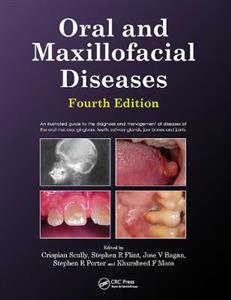 Oral and Maxillofacial Diseases, Fourth Edition - Click Image to Close