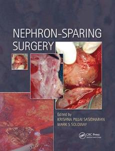 Nephron-Sparing Surgery - Click Image to Close