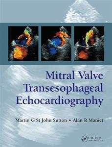 Mitral Valve Transesophageal Echocardiography - Click Image to Close