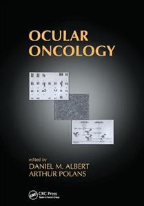 Ocular Oncology - Click Image to Close