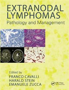 Extranodal Lymphomas