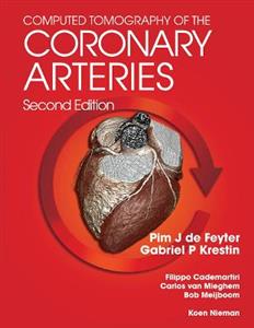 Computed Tomography of the Coronary Arteries - Click Image to Close