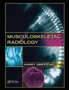 Musculoskeletal Radiology - Click Image to Close