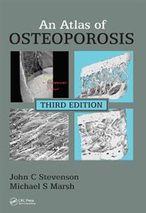 An Atlas of Osteoporosis - Click Image to Close
