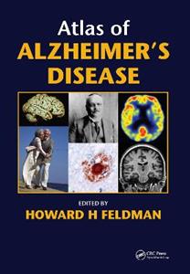 Atlas of Alzheimer's Disease - Click Image to Close