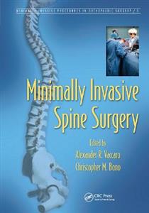 Minimally Invasive Spine Surgery - Click Image to Close