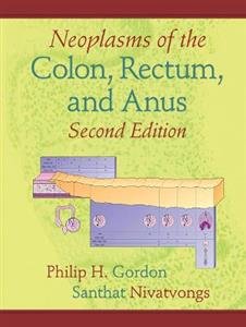 Neoplasms of the Colon, Rectum, and Anus - Click Image to Close