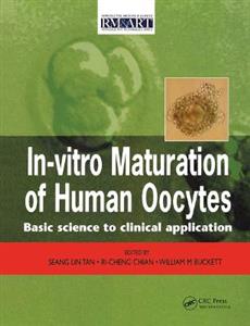 In Vitro Maturation of Human Oocytes - Click Image to Close