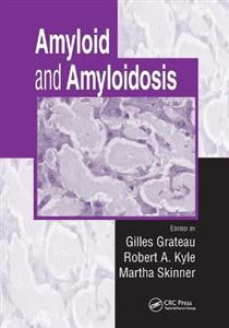 Amyloid and Amyloidosis - Click Image to Close