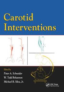 Carotid Interventions - Click Image to Close
