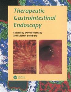 Therapeutic Gastrointestinal Endoscopy - Click Image to Close