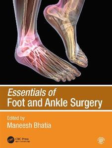 Essentials of Foot and Ankle Surgery - Click Image to Close