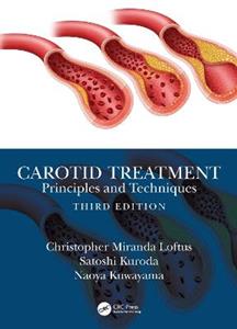 Carotid Treatment: Principles and Techniques - Click Image to Close
