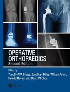 Operative Orthopaedics - Click Image to Close