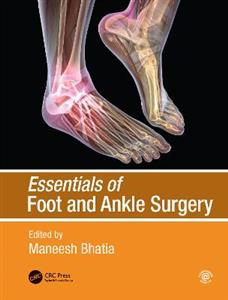 Essentials of Foot and Ankle Surgery - Click Image to Close