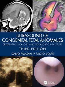 Ultrasound of Congenital Fetal Anomalies: Differential Diagnosis and Prognostic Indicators - Click Image to Close