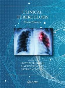Clinical Tuberculosis - Click Image to Close