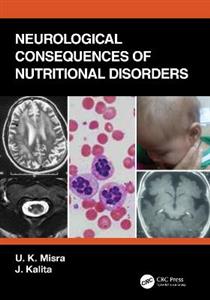 Neurological Consequences of Nutritional Disorders - Click Image to Close