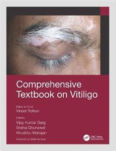 Comprehensive Textbook on Vitiligo - Click Image to Close