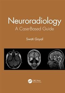 Neuroradiology - Click Image to Close