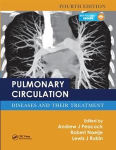 Pulmonary Circulation - Click Image to Close