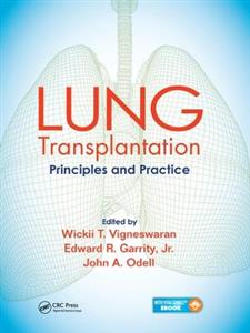 Lung Transplantation - Click Image to Close