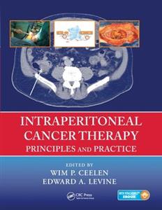 Intraperitoneal Cancer Therapy