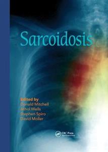 Sarcoidosis - Click Image to Close