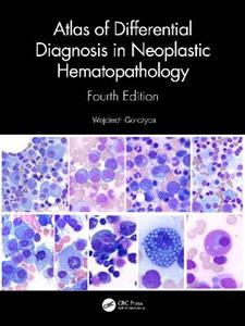 Atlas of Differential Diagnosis in Neoplastic Hematopathology - Click Image to Close