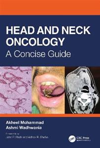 Head and Neck Oncology - Click Image to Close