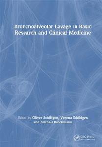 Bronchoalveolar Lavage in Basic Research and Clinical Medicine - Click Image to Close